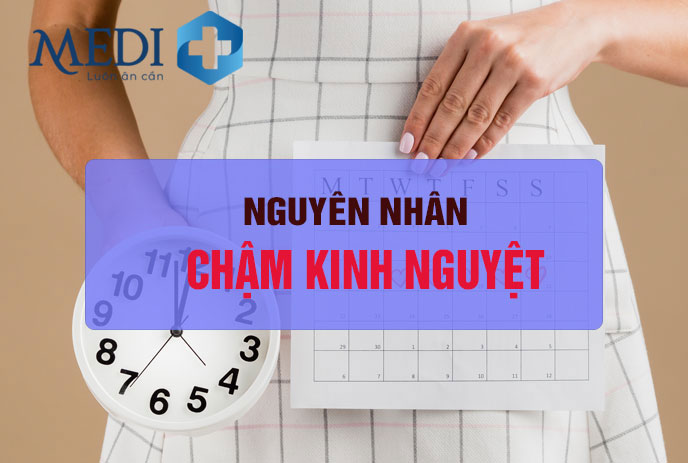 Chậm kinh nguyệt có thể là cảnh báo sớm một số bệnh lý phụ khoa chị em lưu ý