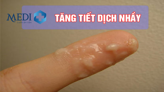 Tăng tiết dịch nhầy âm đạo, một trong các dấu hiệu rụng trứng dễ nhận biết