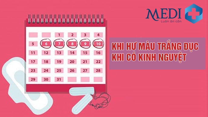 Khí hư màu trắng đục khi tới chu kỳ kinh do lượng khí hư tiết ra nhiều kèm máu kinh