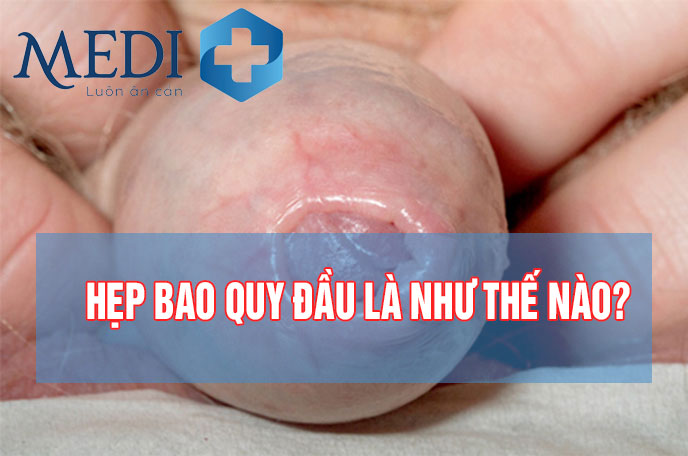 Hẹp bao quy đầu có quan hệ được không? [BÁC SĨ TƯ VẤN]