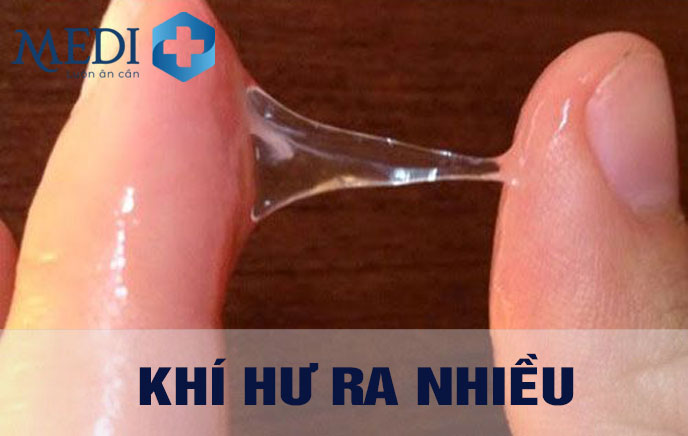 Khí hư ra nhiều cảnh báo tình trạng sức khỏe chị em lưu ý