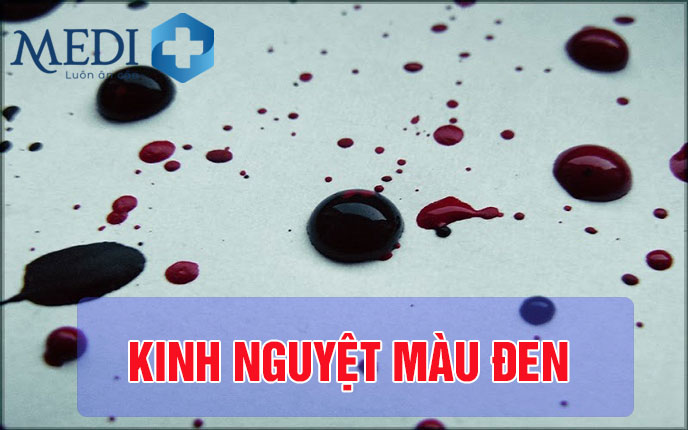 Máu kinh nguyệt màu đen biểu hiện bệnh lý tiềm ẩn chị em cần biết