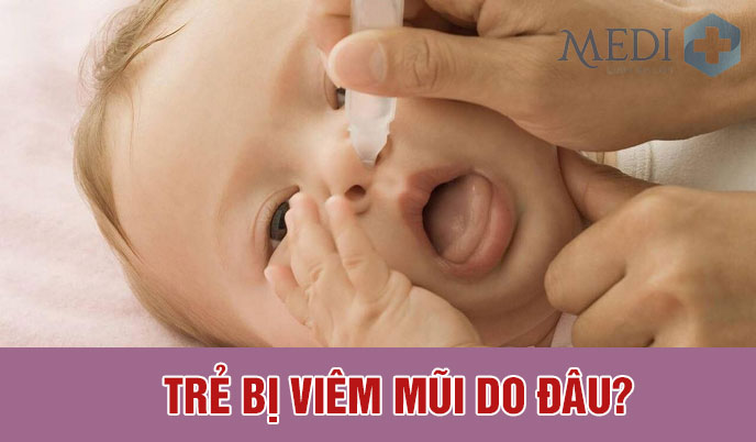 Trẻ bị viêm mũi kéo dài – Cha mẹ tuyệt đối không được chủ quan