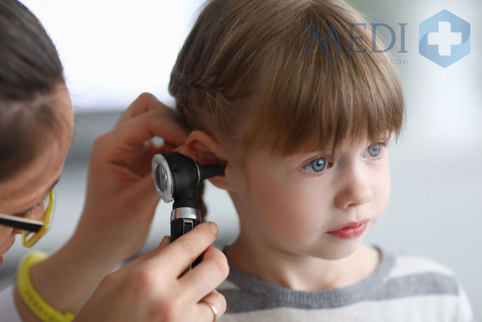 Thăm khám và điều trị sớm viêm tai giữa ở trẻ nhỏ tránh biến chứng