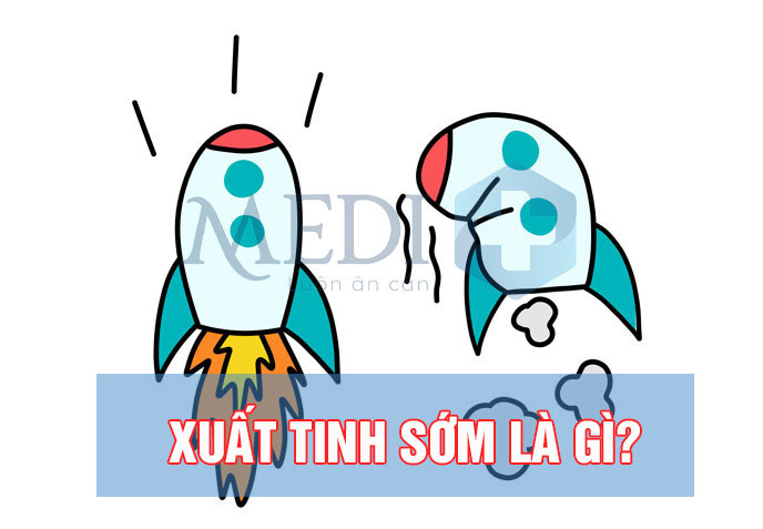 Xuất tinh sớm là gì – “Chưa ra đến chợ đã hết tiền”