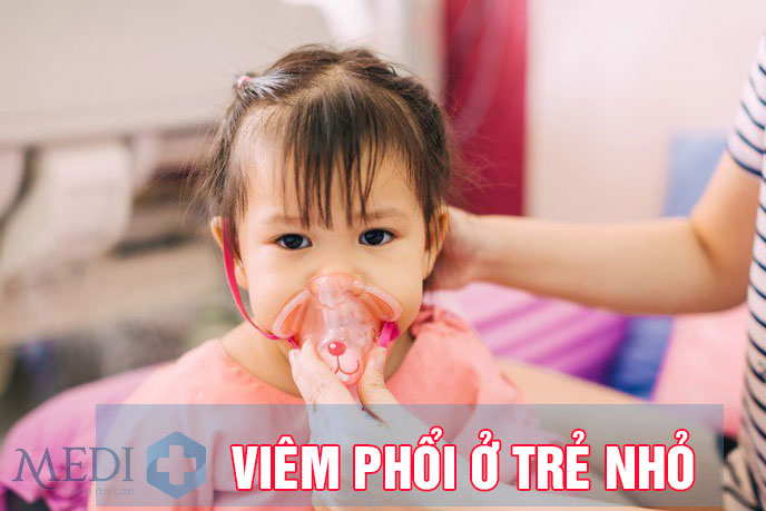 Viêm phổi ở trẻ nhỏ – Biến chứng nguy hiểm cha mẹ chớ chủ quan