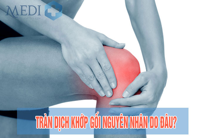 Tràn dịch khớp gối: Nguyên nhân và triệu chứng của bệnh