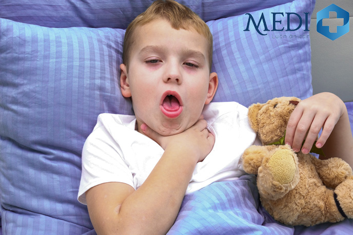 Viêm họng là bệnh lý đường hô hấp thường gặp ở trẻ
