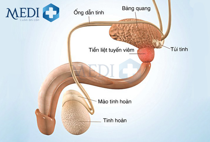 Bệnh viêm tuyến tiền liệt khá phổ biến ở nhiều nam giới