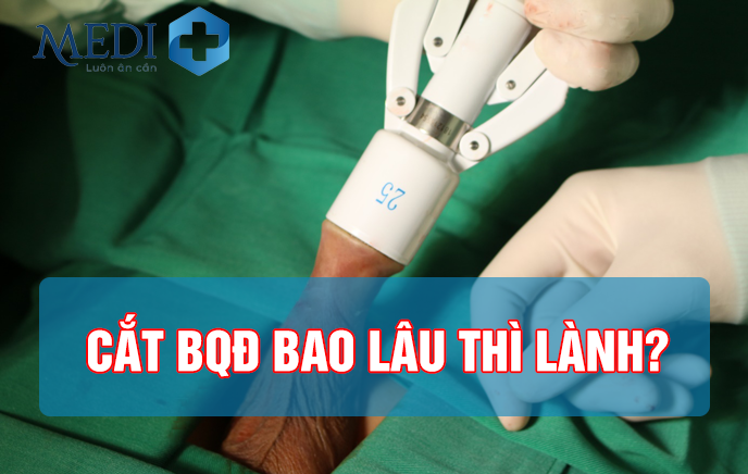 Cắt bao quy đầu bao lâu thì lành, bao lâu thì thay băng?