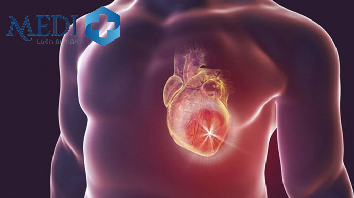 Tràn dịch màng phổi liên quan đến suy tim
