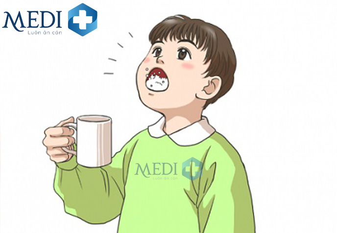 Cho trẻ súc miệng bằng nước muối giúp giảm giảm đau giảm viêm khá tốt