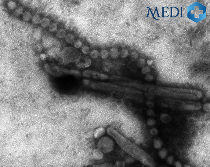 Vius cúm A/H7N9