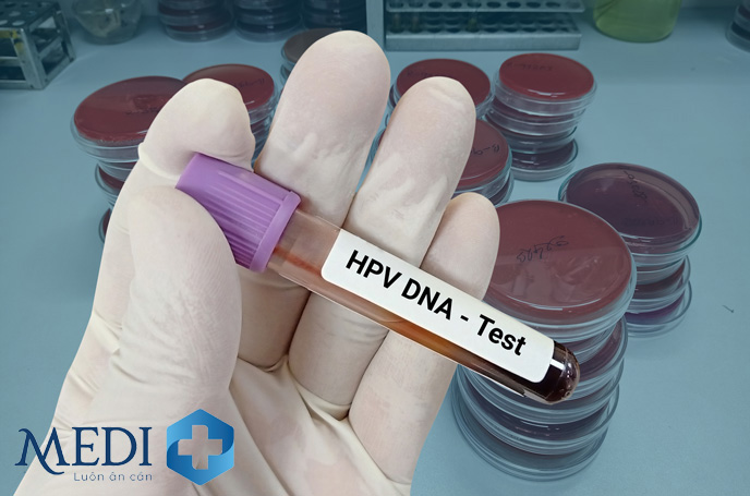 Xét nghiệm HPV là giúp tầm soát ung thư