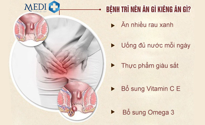 Bệnh trĩ nên ăn gì kiêng ăn gì để khỏi bệnh?