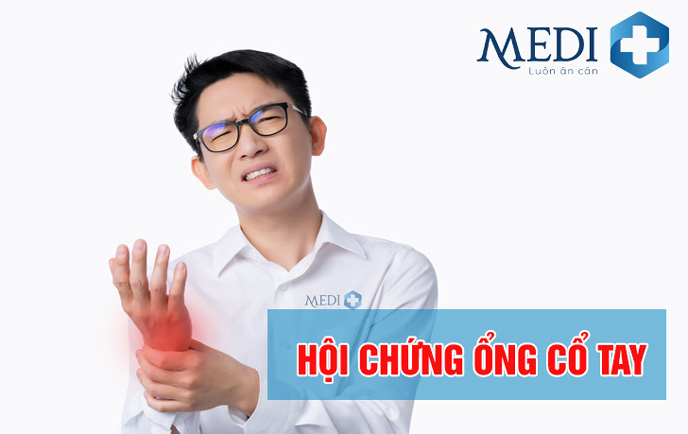 Hội chứng ống cổ tay là gì? Phẫu thuật điều trị hay dùng thuốc?