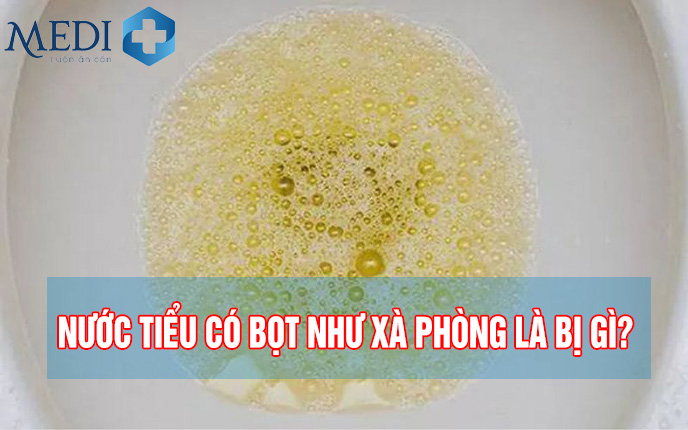 Nước tiểu có bọt như xà phòng là bị bệnh gì?