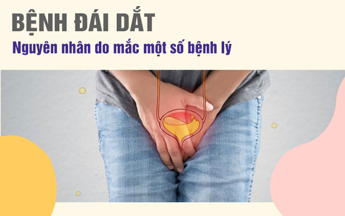 Tiểu rắt có thể do nguyên nhân chủ quan hoặc nguyên nhân bệnh lý