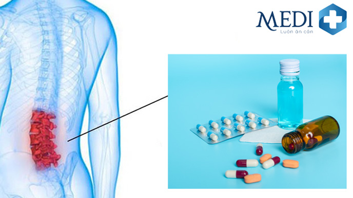 Dùng thuốc là phương pháp điều trị đau cột sống thắt lưng thường dùng