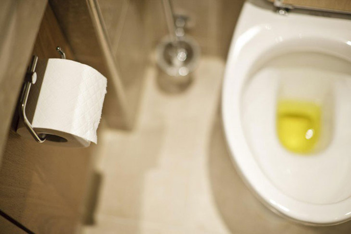 Nước tiểu có màu vàng đục triệu chứng cảnh báo viêm tiết niệu