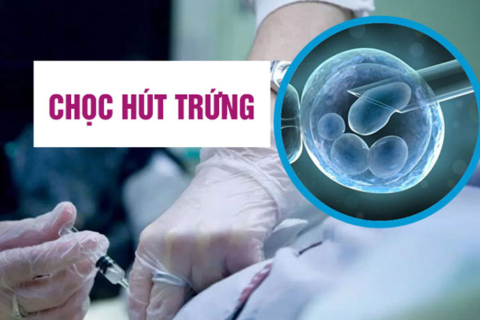 Chọc hút trứng