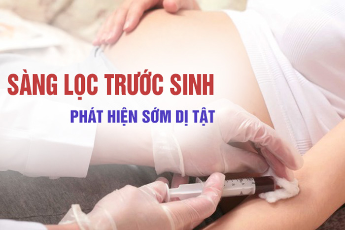 Sàng lọc trước sinh: Phát hiện sớm nguy cơ dị tật thai nhi
