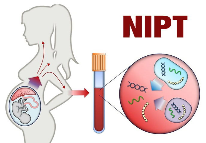 Phương pháp sàng lọc không xâm lấn NIPT-illumina