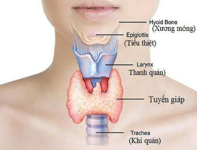 Tuyến giáp hoạt động quá mức gây ra bệnh cường giáp