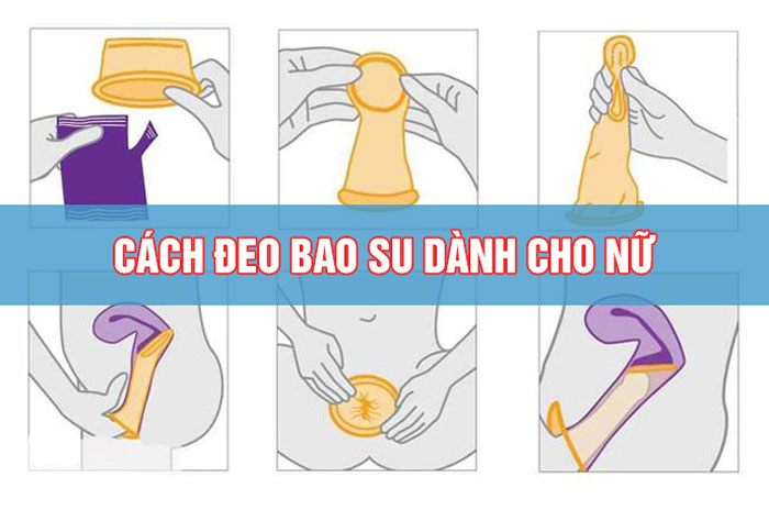 cách sử dụng bao cao su nữ thực tế