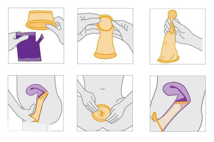 Hướng dẫn cách đeo bao cao su cho nữ giới đúng cách và an toàn