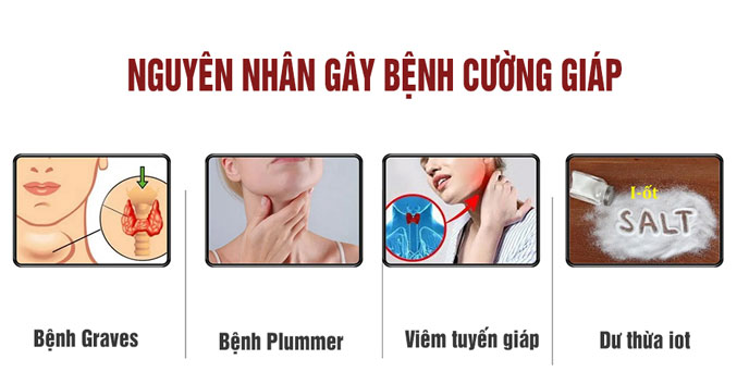 Các yếu tố làm tăng nguy cơ và là nguyên nhân gây bệnh cường giáp