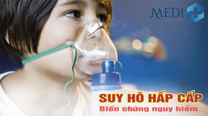 Bệnh suy hô hấp cấp nguy hiểm như thế nào, điều trị ra sao?