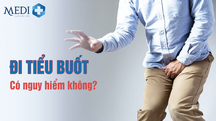 Nên đến cơ sở y tế thăm khám và điều trị kịp thời nếu phát hiện đi tiểu buốt