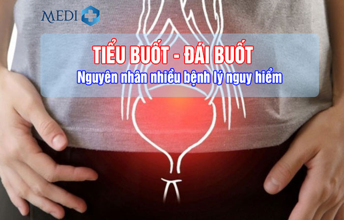 Đi đái buốt (tiểu buốt) – Các bệnh lý thường hay gặp nhất