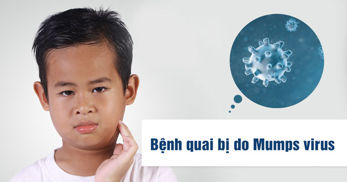 Mumps virus là tác nhân chính gây bệnh quai bị ở trẻ
