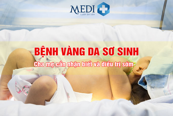 Vàng da sơ sinh khác vàng da bệnh lý Cha mẹ cần biết