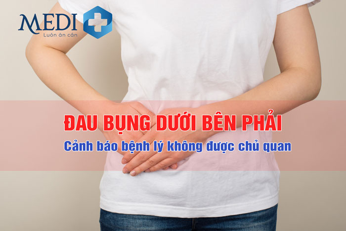 Đau bụng dưới bên phải – Cảnh báo bệnh lý không được chủ quan