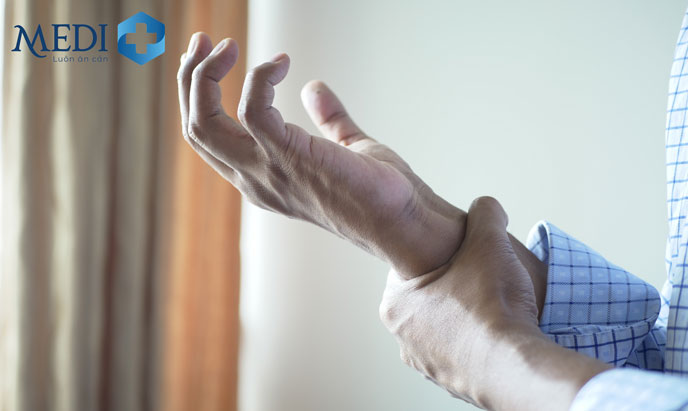 Hội chứng ống cổ tay là một biến chứng của viêm khớp dạng thấp