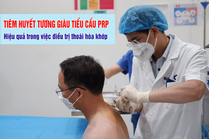 Tiêm huyết tương giàu tiểu cầu PRP điều trị bệnh xương khớp hiệu quả