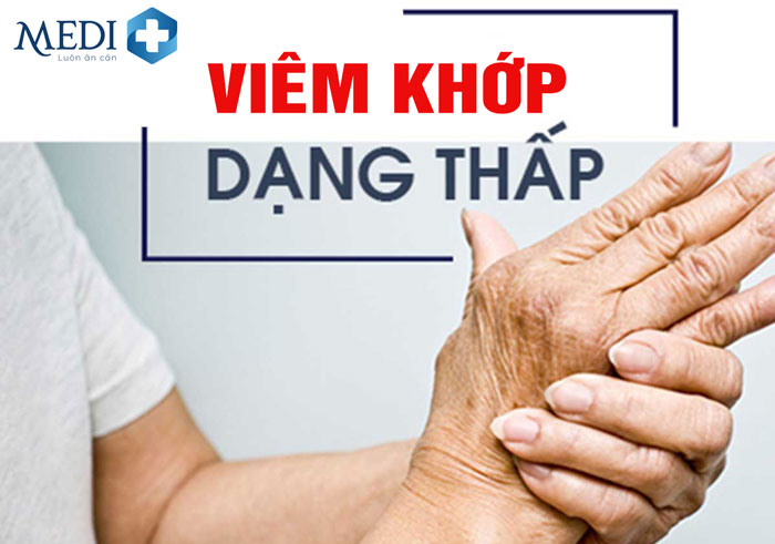 Viêm khớp dạng thấp (thấp khớp) triệu chứng nhận biết và cách điều trị