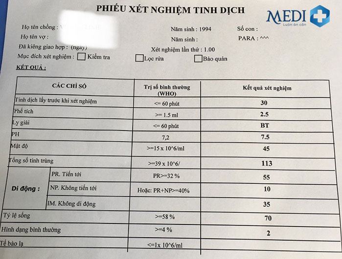 Kết quả xét nghiệm tinh dịch đồ