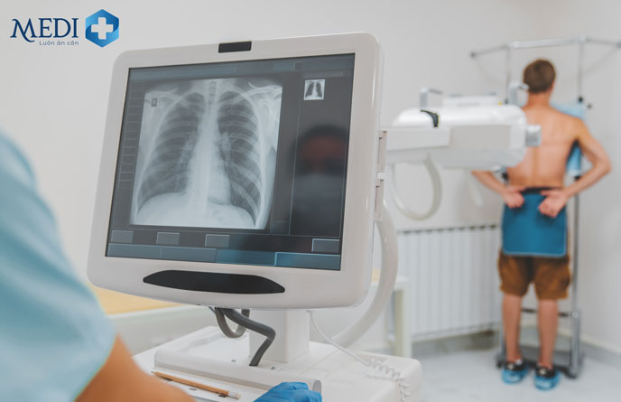 Tầm soát ung thư sớm mang lại nhiều lợi ích cho bệnh nhân 