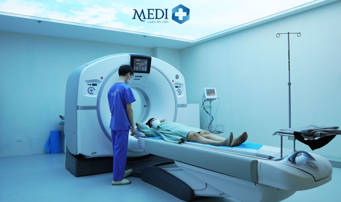 Chụp CT não là chỉ định cần thiết trong chẩn đoán nguyên nhân đột quỵ