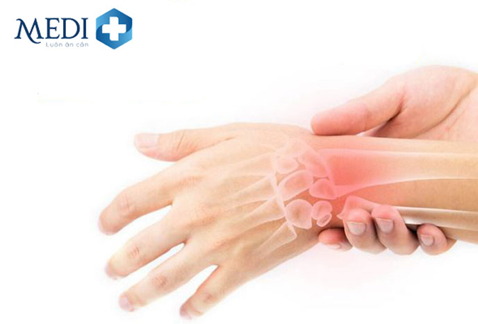 Thoái hóa khớp ngón tay, cổ tay thường xảy ra ở đối tượng khoảng 60-65 tuổi