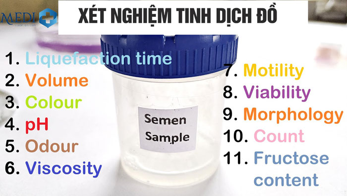 Xét nghiệm tinh dịch đồ: Khi nào cần và chi phí hết bao nhiêu tiền?