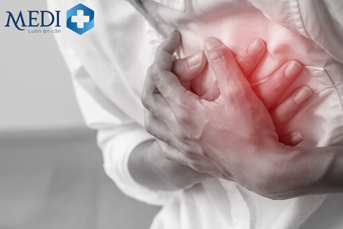 Bệnh gút có thể gây biến chứng nhồi máu cơ tim