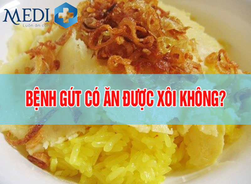 Bệnh gout có ăn được xôi không? Những điều bạn cần biết 