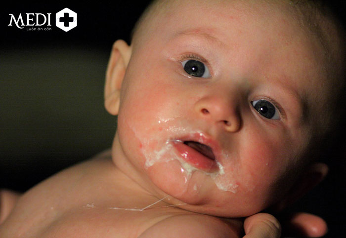 Trẻ bị nôn trớ sữa sau khi bú 