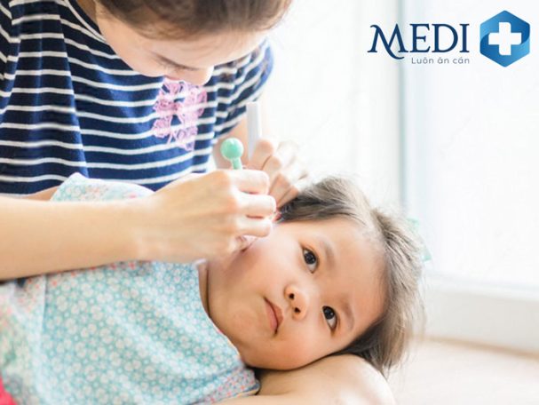 Cách lấy ráy tai cho bé, xử lý ráy tai khô và vón cục