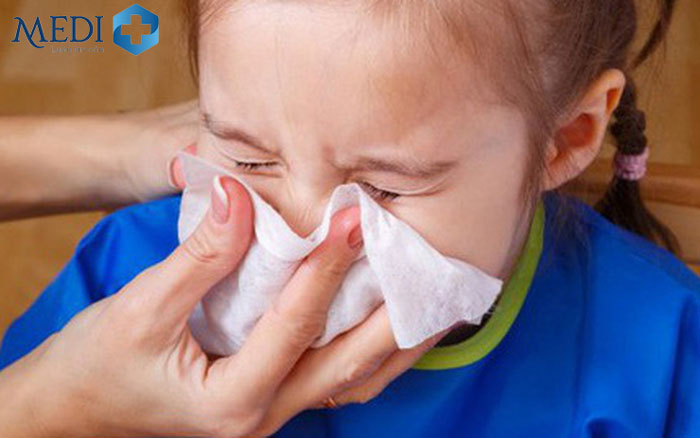 Trẻ bị viêm mũi dị ứng rất dễ gặp khi thời tiết giao mùa